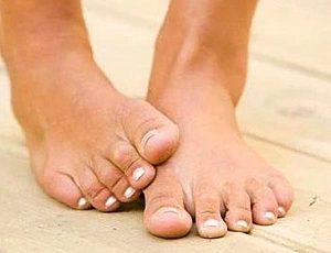 20 best remedies for nail fungus