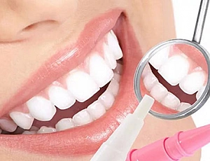 10 meilleurs blanchisseurs de dents d'Aliexpress