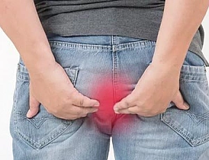 Top 10 Hemorrhoid Remedies