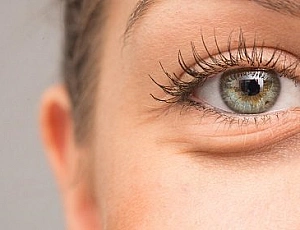 Top 10 remedies for puffy eyes