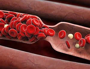 Top 10 Blood Thinners