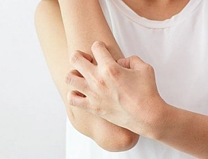 10 best remedies for itchy skin