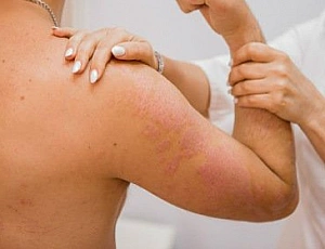 Top 10 des cliniques de traitement du psoriasis à Moscou