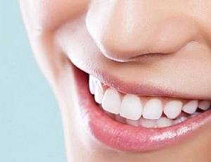 Top 10 Teeth Whitening Products