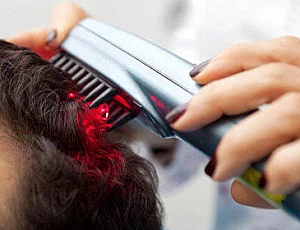 5 meilleurs peignes laser pour la perte de cheveux